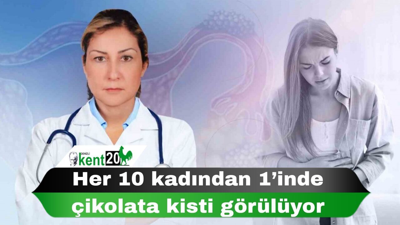 Her 10 kadından 1’inde çikolata kisti görülüyor