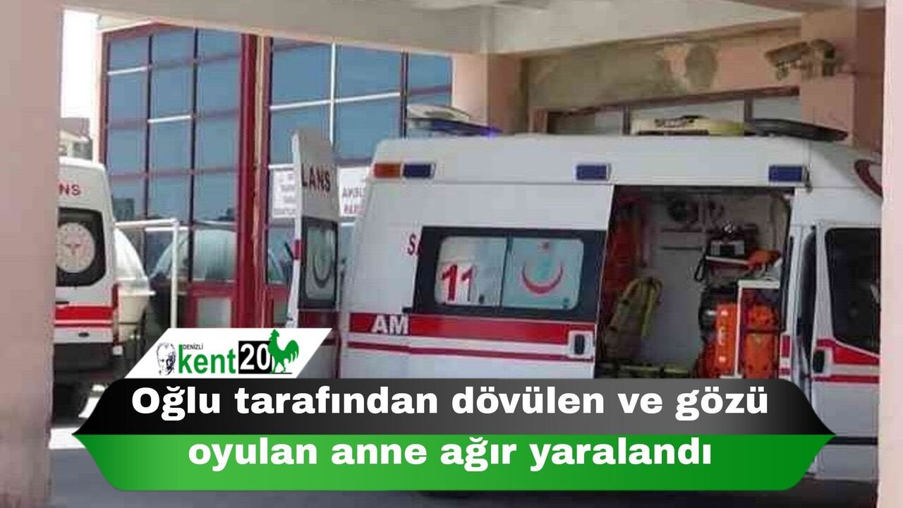 Oğlu tarafından dövülen ve gözü oyulan anne ağır yaralandı