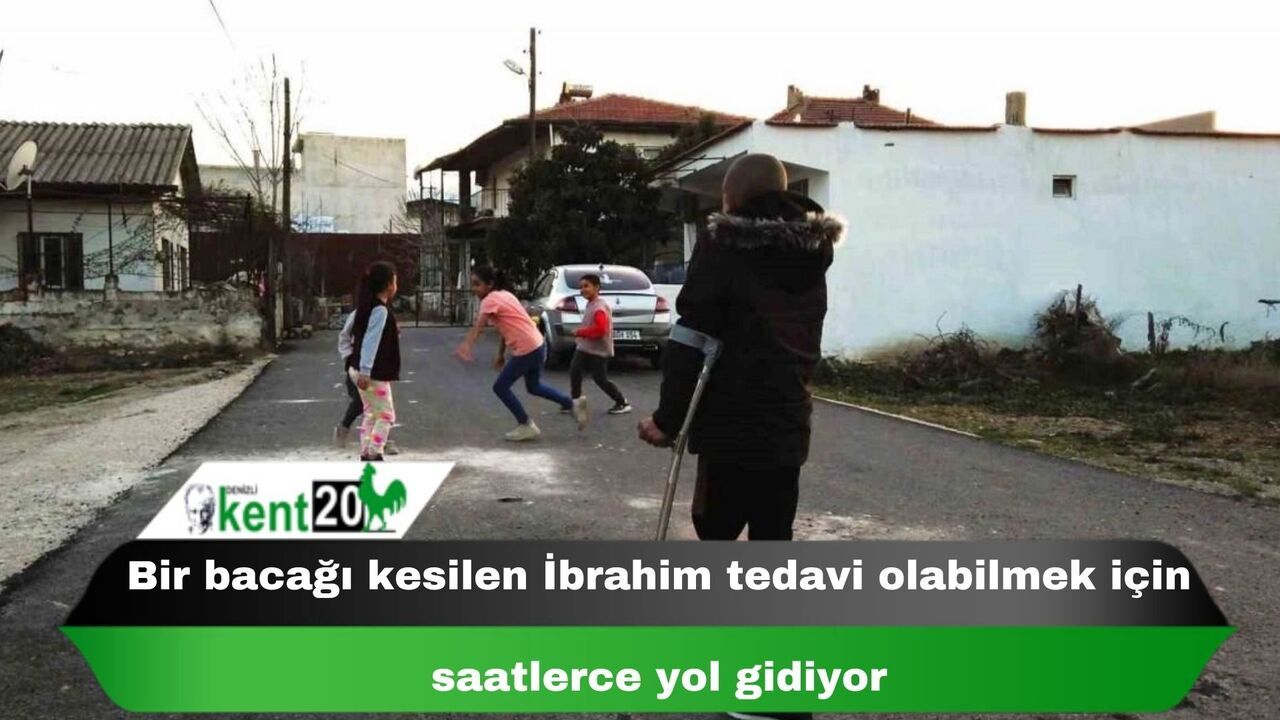 Bir bacağı kesilen İbrahim tedavi olabilmek için saatlerce yol gidiyor