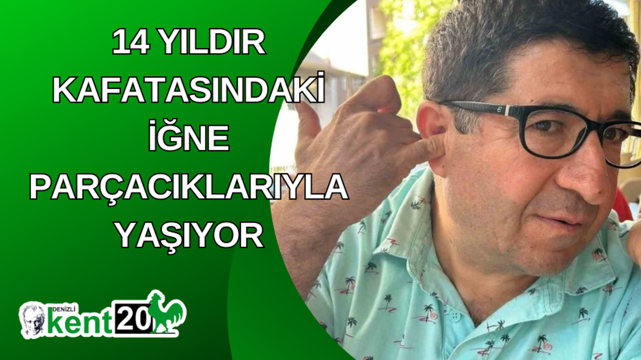 14 yıldır kafatasındaki iğne parçacıklarıyla yaşıyor