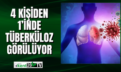 4 kişiden 1’inde tüberküloz görülüyor