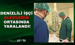 Denizlili İşçi Alevlerin Ortasında Yaralandı!