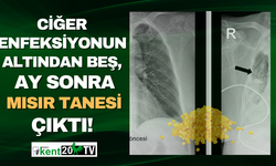 Denizli'de nefes borusuna kaçan mısır, beş ay sonra çıkarıldı!
