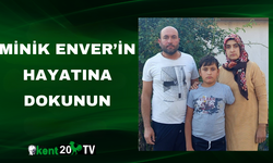 Minik Enver’in Hayatına Dokunun