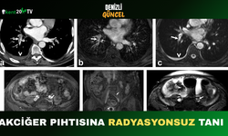 Akciğer Pıhtısına Radyasyonsuz Tanı