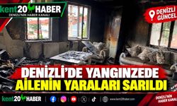 Denizli’de yangınzede ailenin yaraları sarıldı
