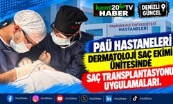 PAÜ Hastaneleri Dermatoloji Saç Ekimi Ünitesinde Saç Transplantasyonu Uygulamaları
