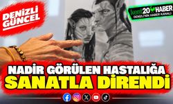 Nadir görülen hastalığa sanatla direndi