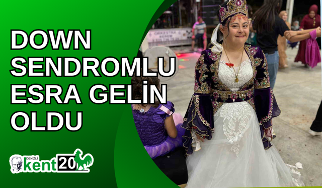 Down sendromlu Esra gelin oldu