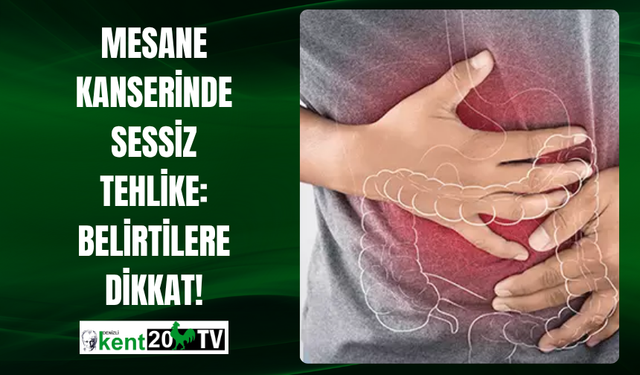 Mesane Kanserinde Sessiz Tehlike: Belirtilere Dikkat!