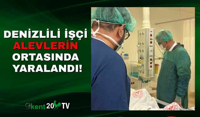 Denizlili İşçi Alevlerin Ortasında Yaralandı!