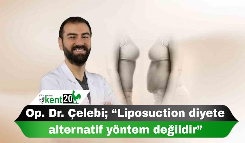 Op. Dr. Çelebi; “Liposuction diyete alternatif yöntem değildir”