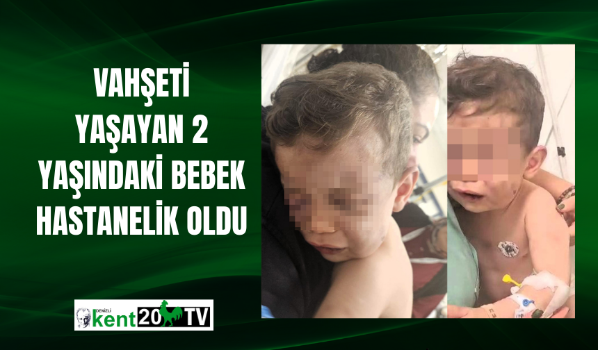 Darp sonucu hastanelik olan bebek devlet korumasına alınacak