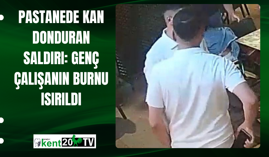 Pastanede Kan Donduran Saldırı: Genç Çalışanın Burnu Isırıldı