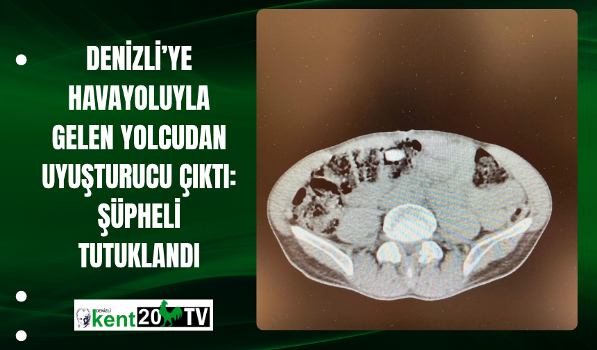Denizli’ye Havayoluyla Gelen Yolcudan Uyuşturucu Çıktı: Şüpheli Tutuklandı