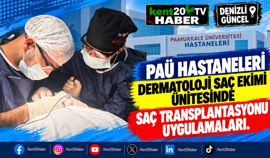 PAÜ Hastaneleri Dermatoloji Saç Ekimi Ünitesinde Saç Transplantasyonu Uygulamaları
