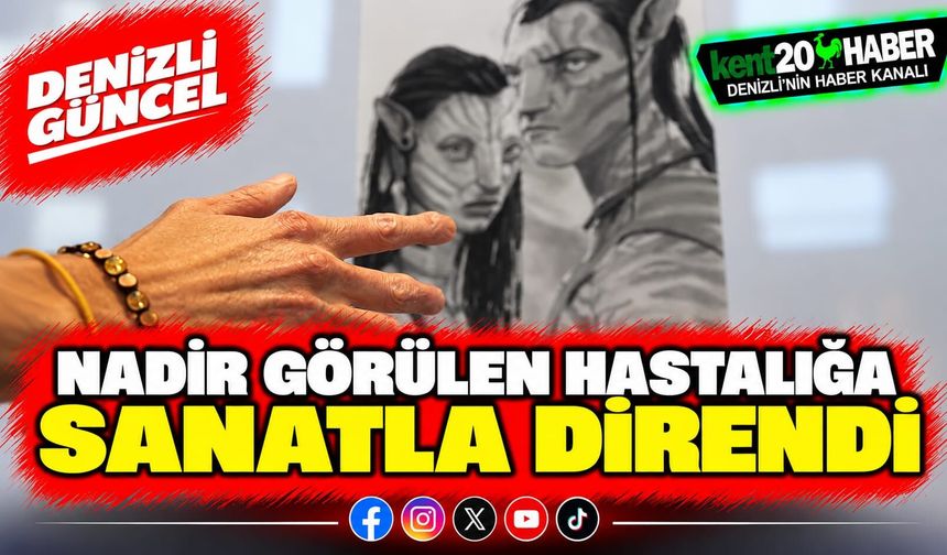 Nadir görülen hastalığa sanatla direndi